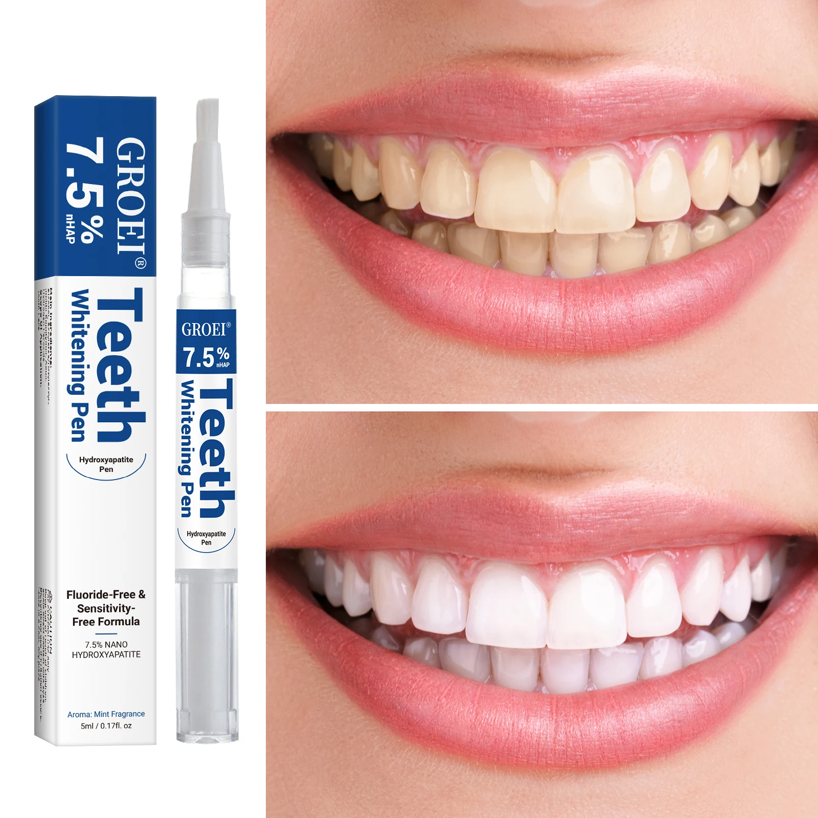 Hydroxyapatite Tooth Whitening - Teeth Whitening Gels Used By Dentists ulasan dan harga