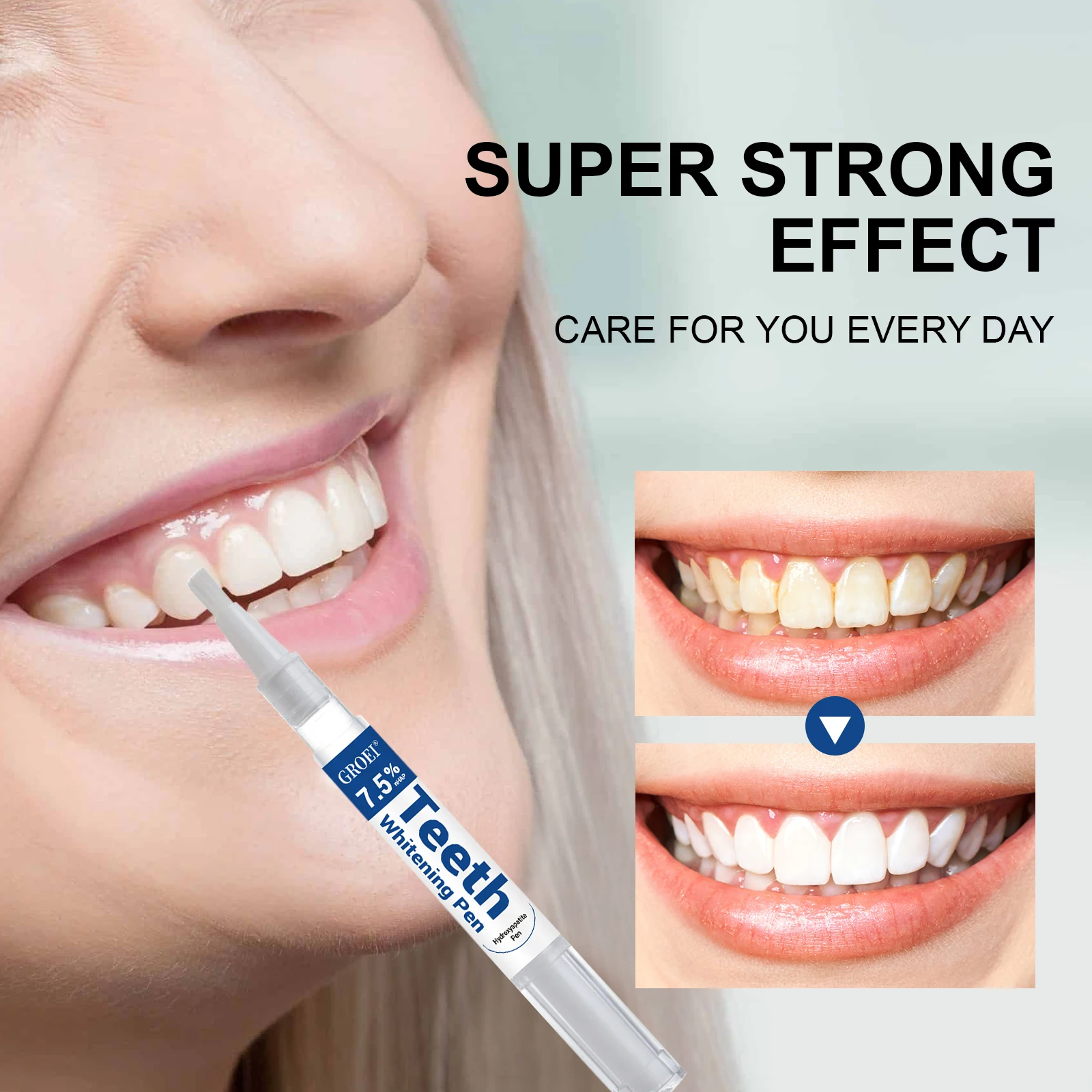 Hydroxyapatite Tooth Whitening - Teeth Whitening Gels Used By Dentists ulasan dan harga