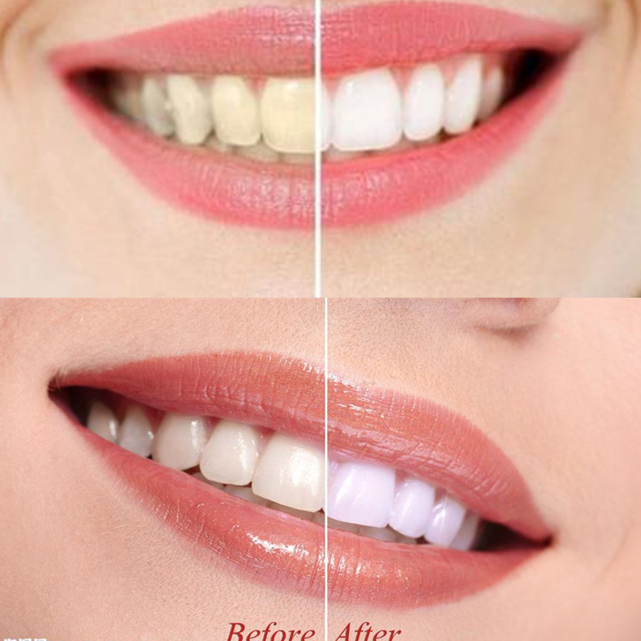 Bamboo Charcoal Teeth Tooth De - Teeth Whitening App ulasan dan harga