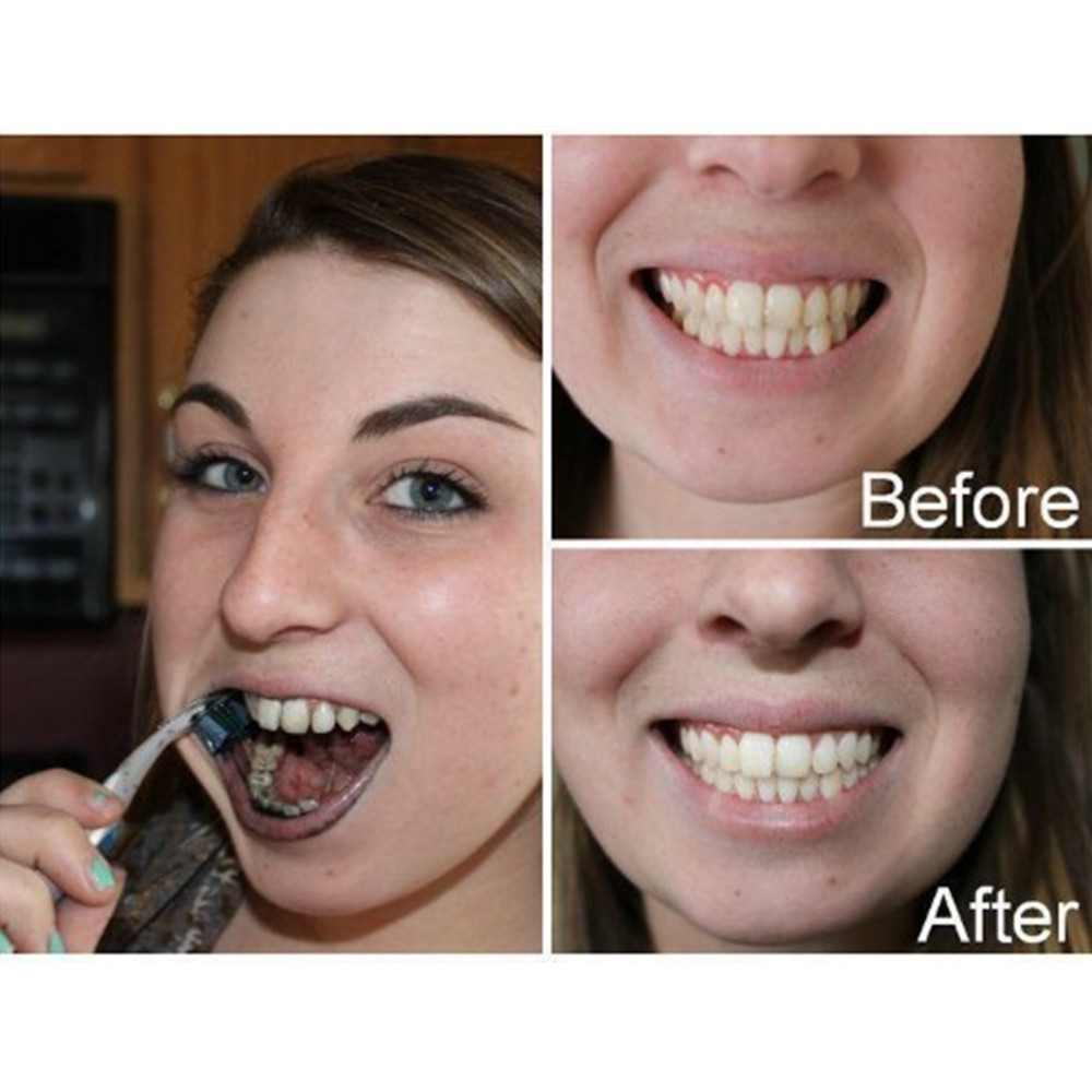 Bamboo Charcoal Teeth Tooth De - Teeth Whitening App ulasan dan harga