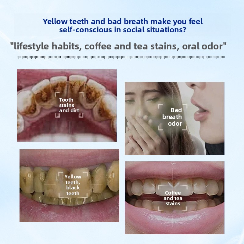 Enzyme Brightening and Whiteni - Teeth Whitening Enzymes ulasan dan harga