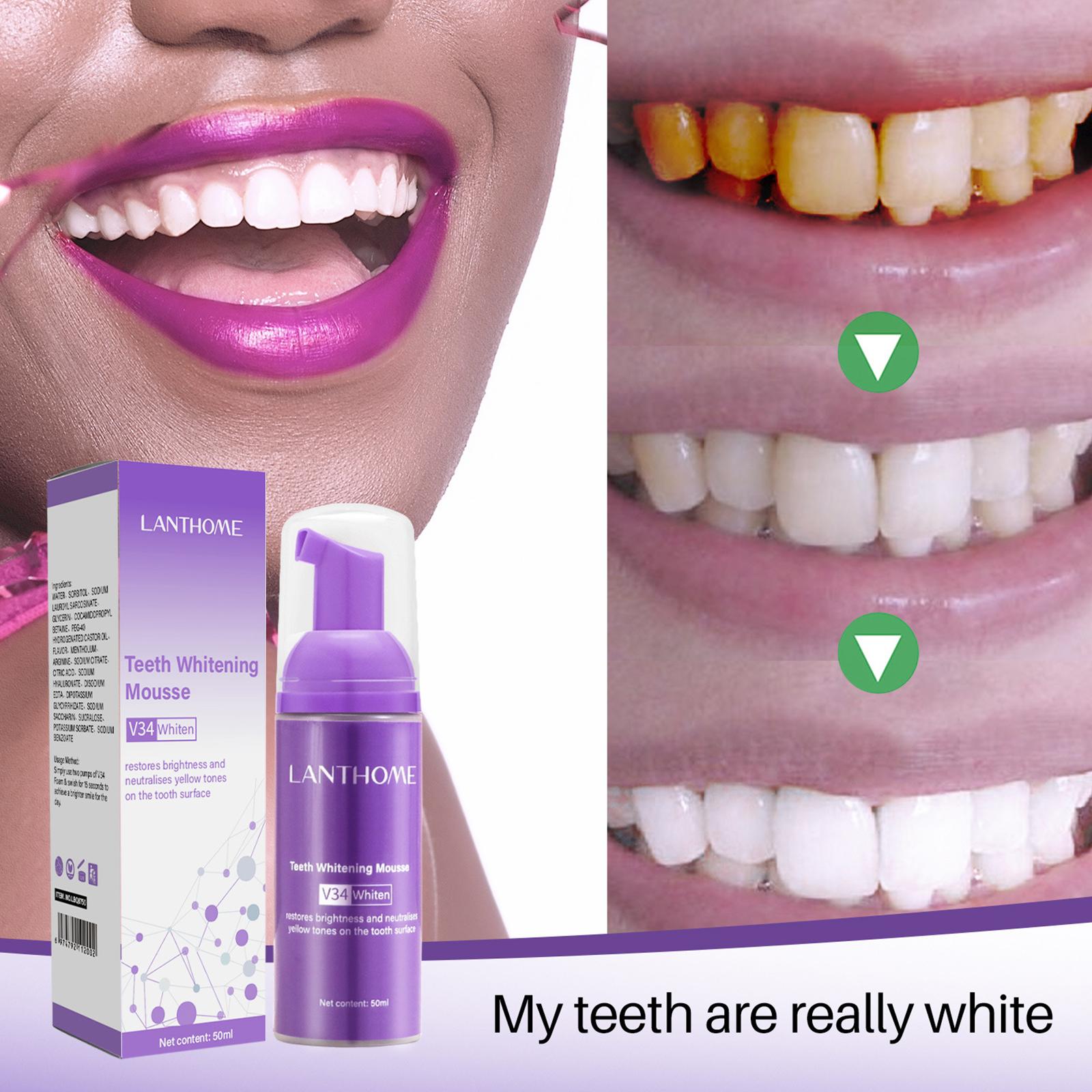 V34 Mousse Teeth Cleaning Toot - Teeth Whitening Yellow Teeth ulasan dan harga