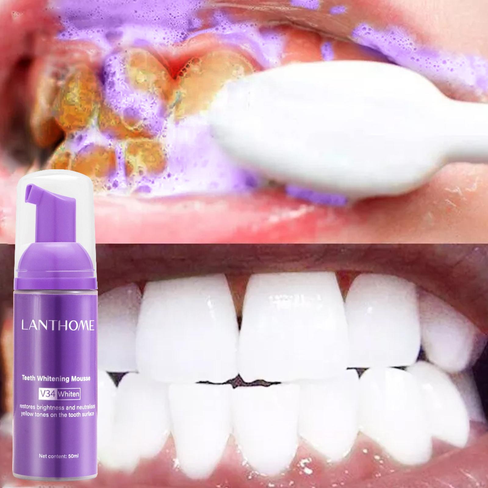V34 Mousse Teeth Cleaning Toot - Teeth Whitening Yellow Teeth ulasan dan harga