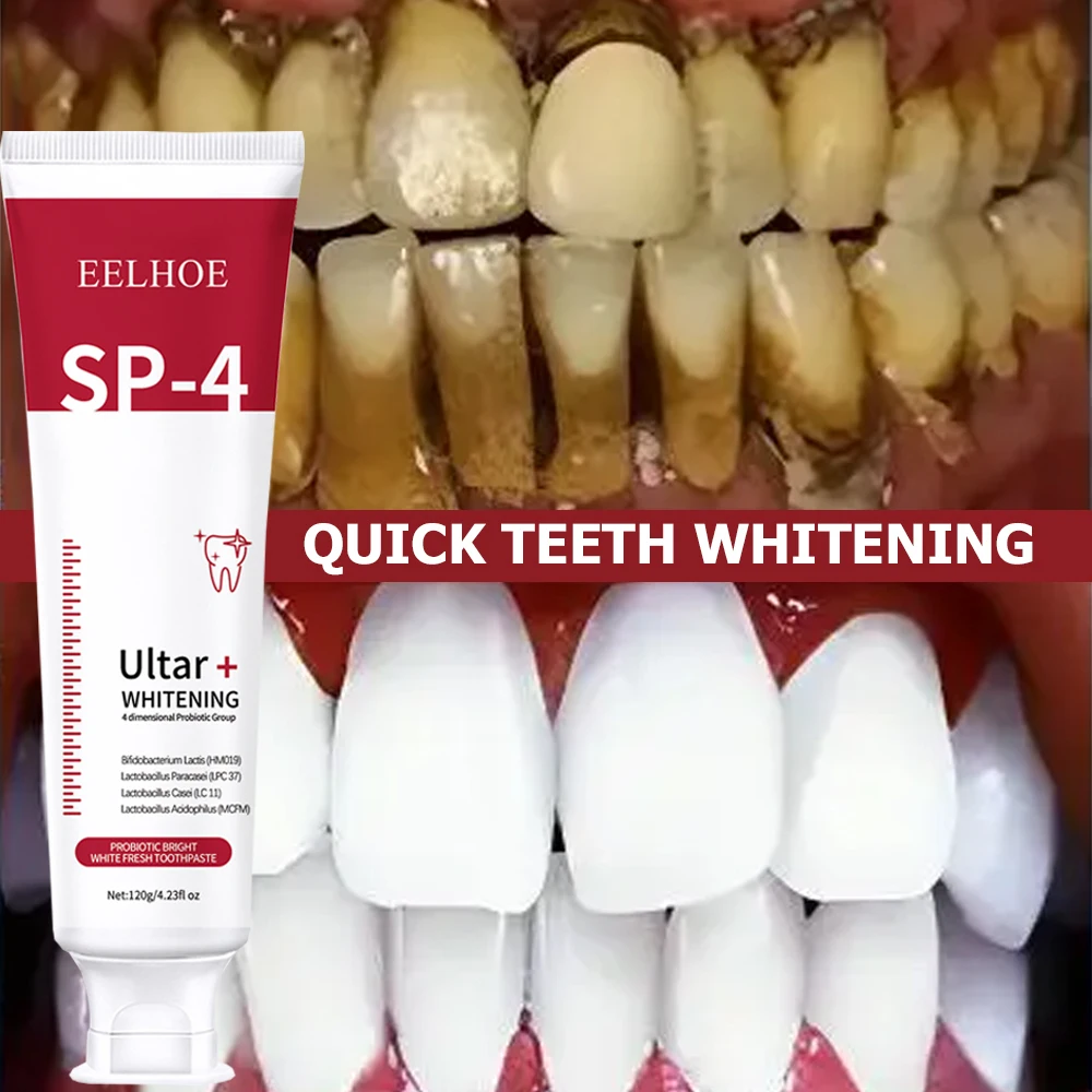 5pcs Sp-4 120g Probiotic White - Teeth Whitening Enzymes ulasan dan harga