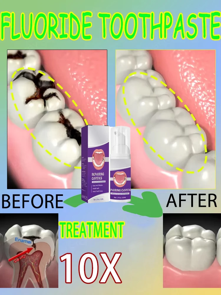 Hot sales Best-selling, Scient - Teeth Whitening That Works ulasan dan harga