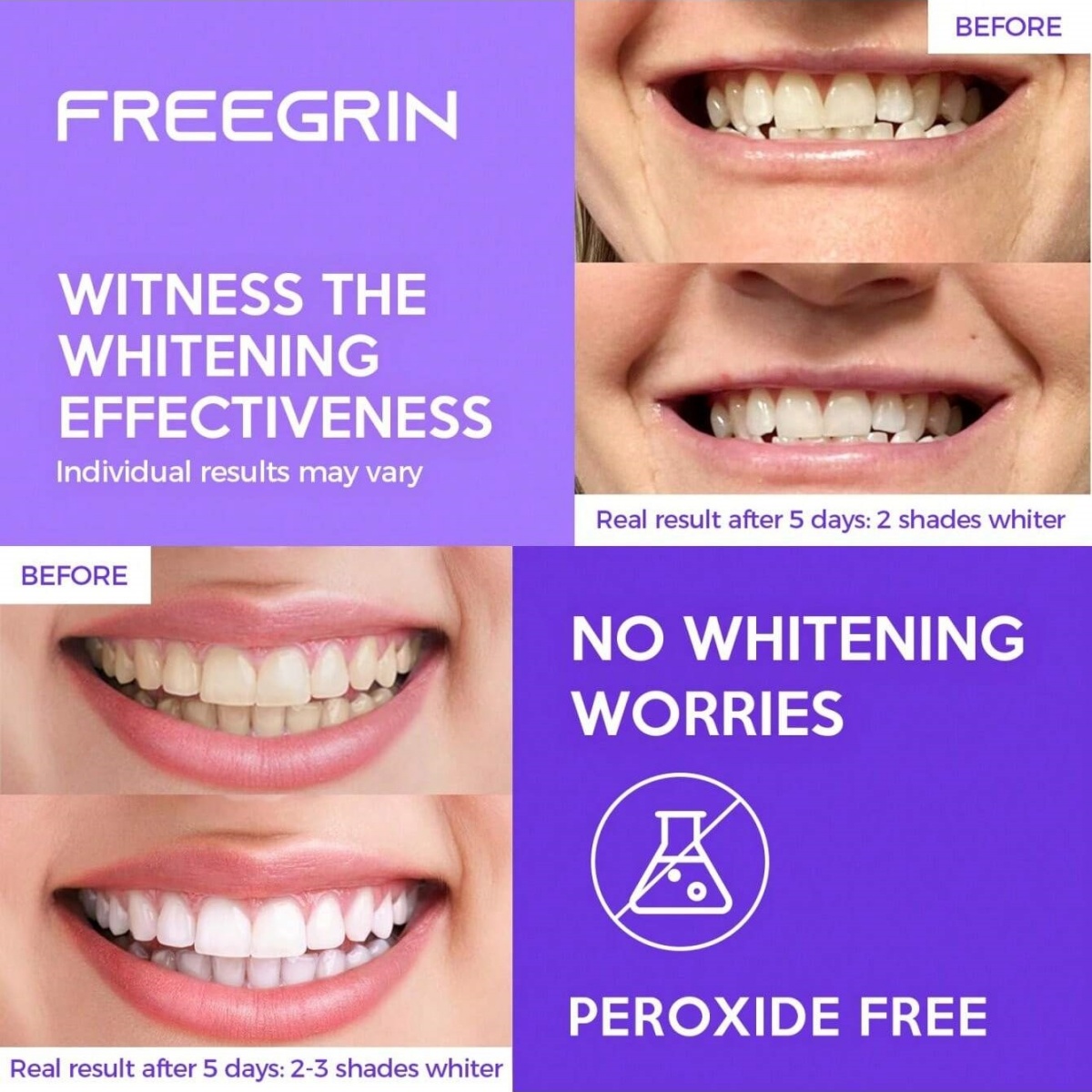 Deluxe Whitening Teeth Sticker - Teeth Whitening App ulasan dan harga