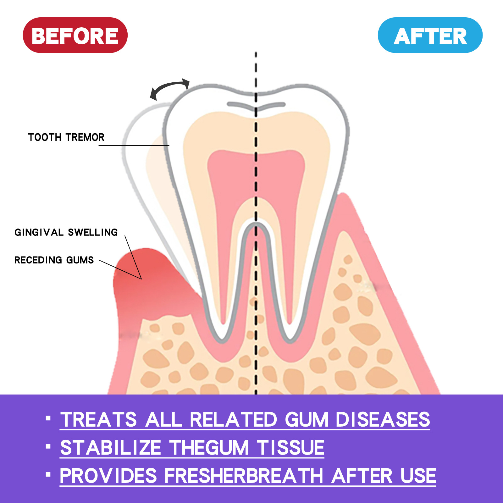 60ml Teeth Whitening Mousse V3 - Teeth Whitening Yellow Teeth ulasan dan harga